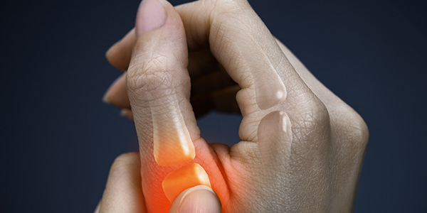 Image representing ARTHRITIS